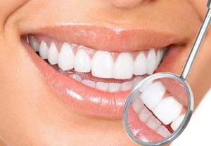 Some Benefits to Giving Your Smile an Extra Boost