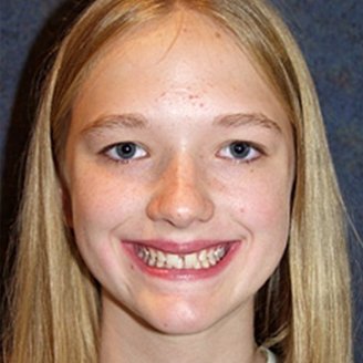 Hoybjerg Family Orthodontics | Christian Hoybjerg DDS, MS